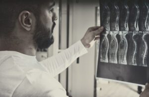 ¿Qué es una lesión de la médula espinal?