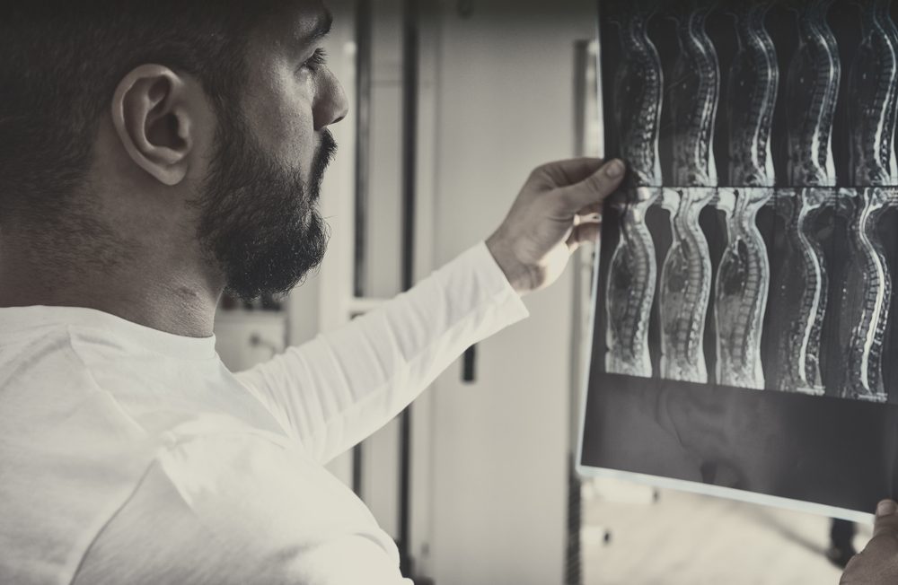What Is a Spinal Cord Injury?